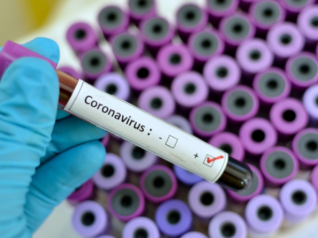 Koronavirüs nedir?: Covid-19 belirtileri neler, Türkiye'de kaç vaka var?
