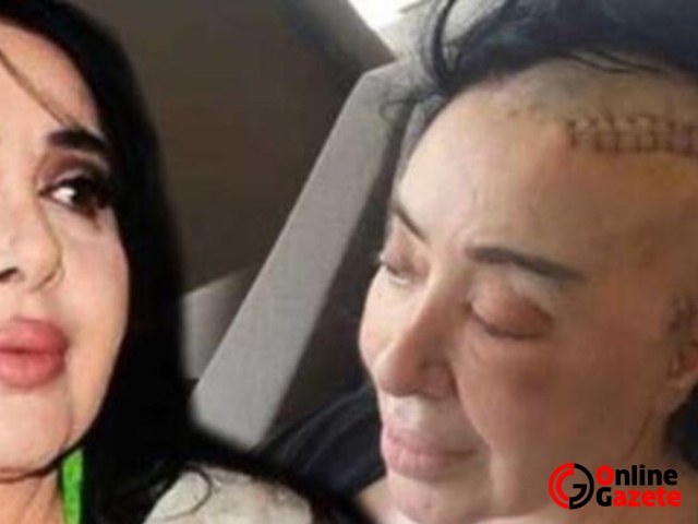 Ölüm haberi yasa boğdu: Nur Yerlitaş kimdir, hastalığı neydi?