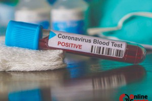 Türkiye'de korona virüs ölümleri giderek artıyor